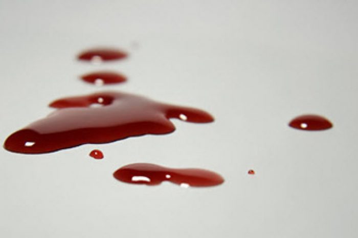 خودکشی - خودکشی نافرجام دختر ۱۵ ساله در لاهیجان - خودکشی