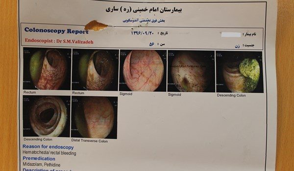 خارج کردن باند استریل پس از 10 سال از بدن بیمار تصاویر 1 - خارج کردن باند استریل پس از 10 سال از بدن بیمار + تصاویر - باند استریل