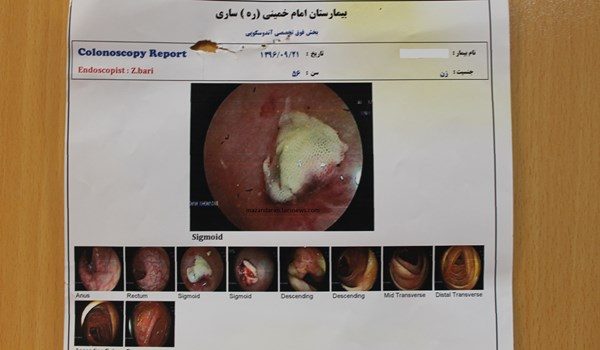 خارج کردن باند استریل پس از 10 سال از بدن بیمار تصاویر 2 - خارج کردن باند استریل پس از 10 سال از بدن بیمار + تصاویر - باند استریل