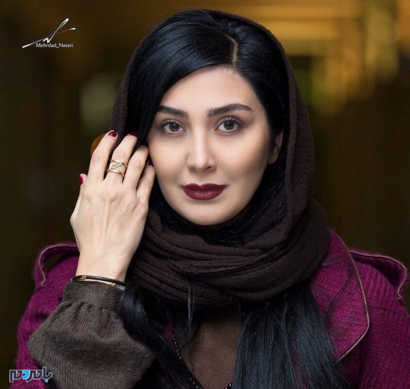 چهره کبود بازیگر زن ایرانی | حمله فیزیکی به مریم معصومی + عکس