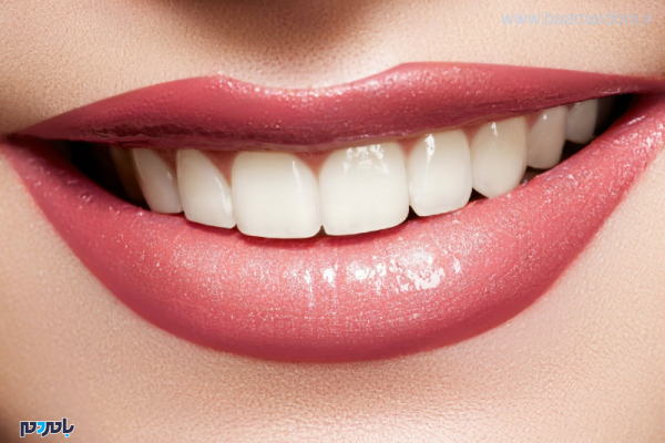 دندان 600x400 - درمان زردی دندان در منزل با سرکه سیب