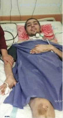 صادق فرضی‌زاده 2 - وزنه‌بردار گیلانی در آستانه فلج شدن - صادق فرضی‌زاده