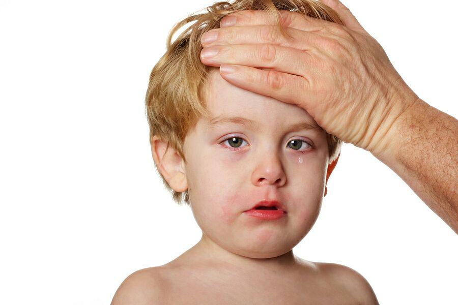 بیماری کاوازاکی ربطی به کرونا ندارد/علائم کاوازاکی چیست؟