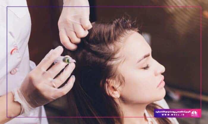hair mesotherapy - راه‌های واقعاً موثر برای درمان و جلوگیری از ریزش مو - جلوگیری از ریزش مو