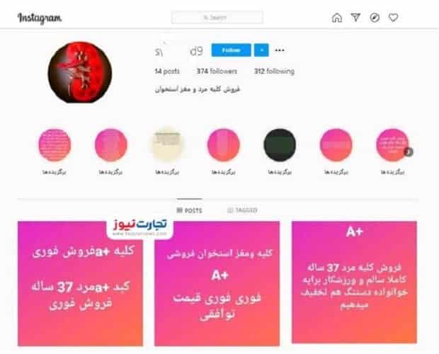 Hid - بازار خرید و فروش اعضای بدن / کلیه ۱۵۰، ‌نیمی از کبد ۲۰۰ میلیون تومان! - اعضای بدن