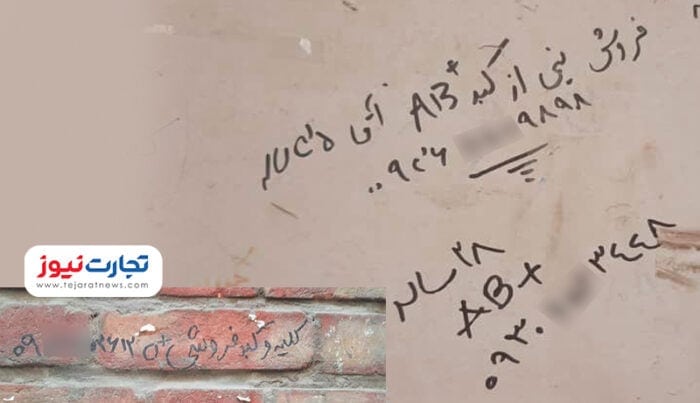 بدن - بازار خرید و فروش اعضای بدن / کلیه ۱۵۰، ‌نیمی از کبد ۲۰۰ میلیون تومان! - اعضای بدن