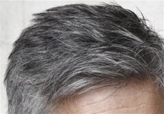موهای خاکستری می تواند دوباره سیاه شود!