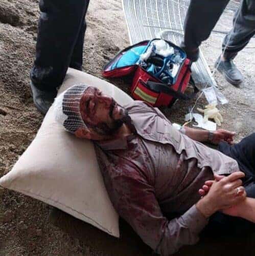 5vPF0g8pKEum - انتشار نخستین تصویر خونین شهردار تهران پس از حمله افراد ناشناس با چاقو - تصویر خونین شهردار تهران
