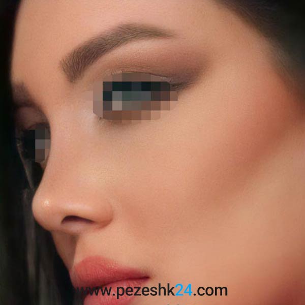 word image 198886 2 - راهنمای انتخاب بهترین جراح بینی - pezeshk24