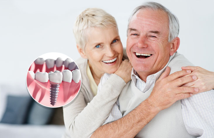 word image 200604 2 - ایمپلنت دندان بدون درد - ایمپلنت دندان
