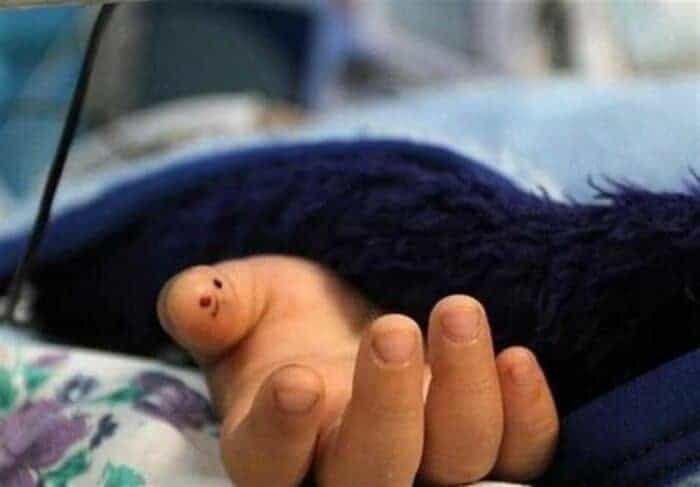 فوت مرگ جسد جنازه خودکشی - فوت یک دختر خردسال بر اثر مصرف مشروبات الکلی - دختر