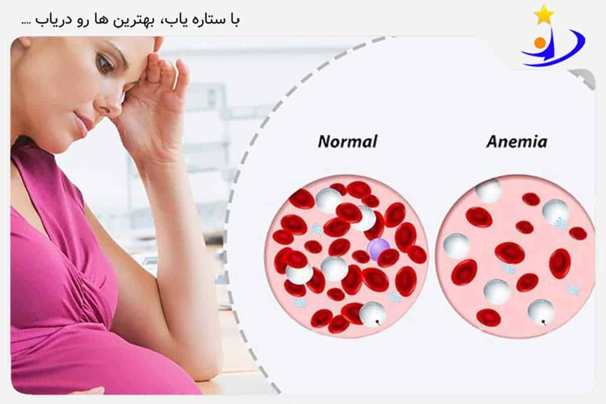 دلایل کم خونی در بانوان باردار چیست؟