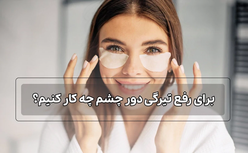 برای رفع تیرگی دور چشم چه کار کنیم؟ 10 راه حل تضمینی + معرفی محصول