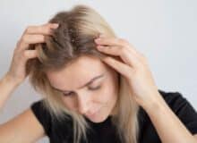 علت خارش سر و ریزش مو در زنان چیست؟