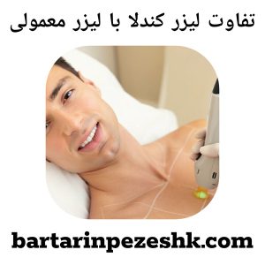 تفاوت لیزر کندلا با لیزر معمولی