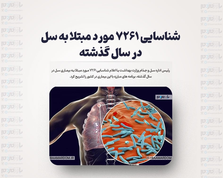 شناسایی ۷۲۶۱ مورد مبتلا به سل در سال گذشته
