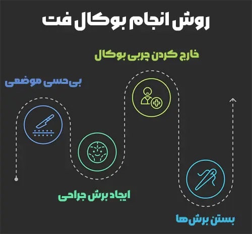 اینفوگرافیک مراحل انجام بوکال فت