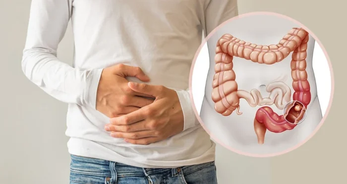 2 min - مزایا و معایب رژیم گیاه‌خواری و تاثیر آن بر سرطان - تاثیر گیاهخواری بر سرطان