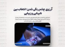 آرزوی چشم رنگی شدن؛ انتخاب بین نابینایی و زیبایی