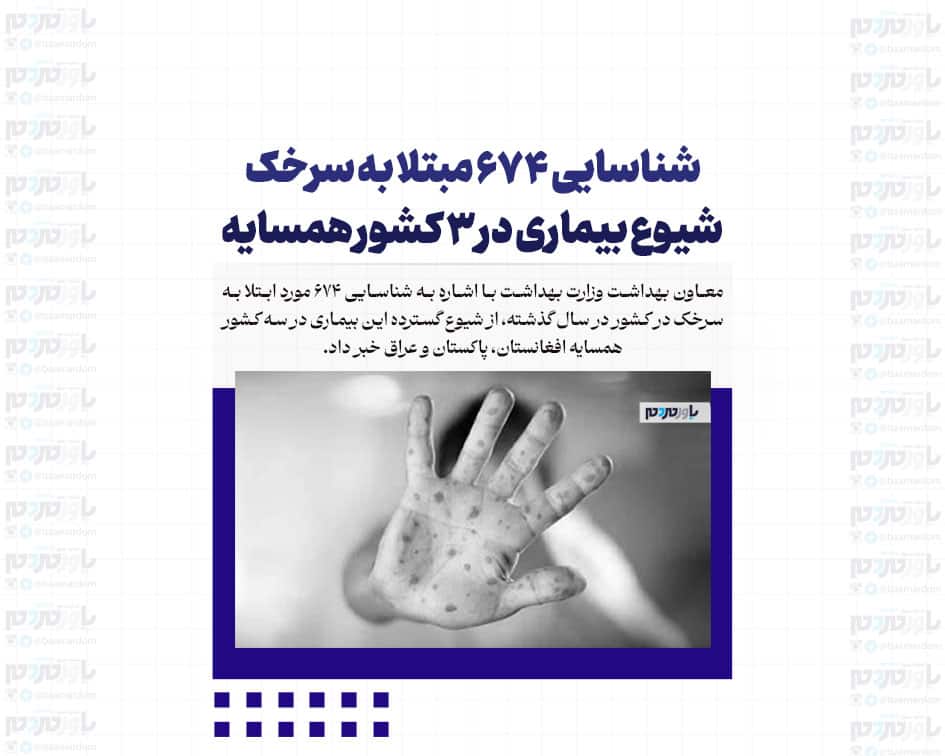 شناسایی ۶۷۴ مبتلا به سرخک/ شیوع بیماری در ۳ کشور همسایه