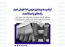 ترامپ به بیماری مزمن اما خوش‌خیم رگ‌های پا مبتلاست