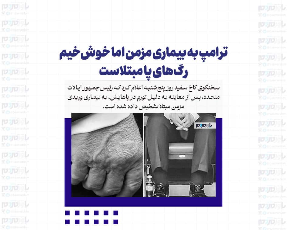 ترامپ به بیماری مزمن اما خوش‌خیم رگ‌های پا مبتلاست