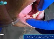 چرا انتخاب دکتر ایمپلنت دیجیتال در شیراز اهمیت دارد؟ راهنمای کامل بیماران