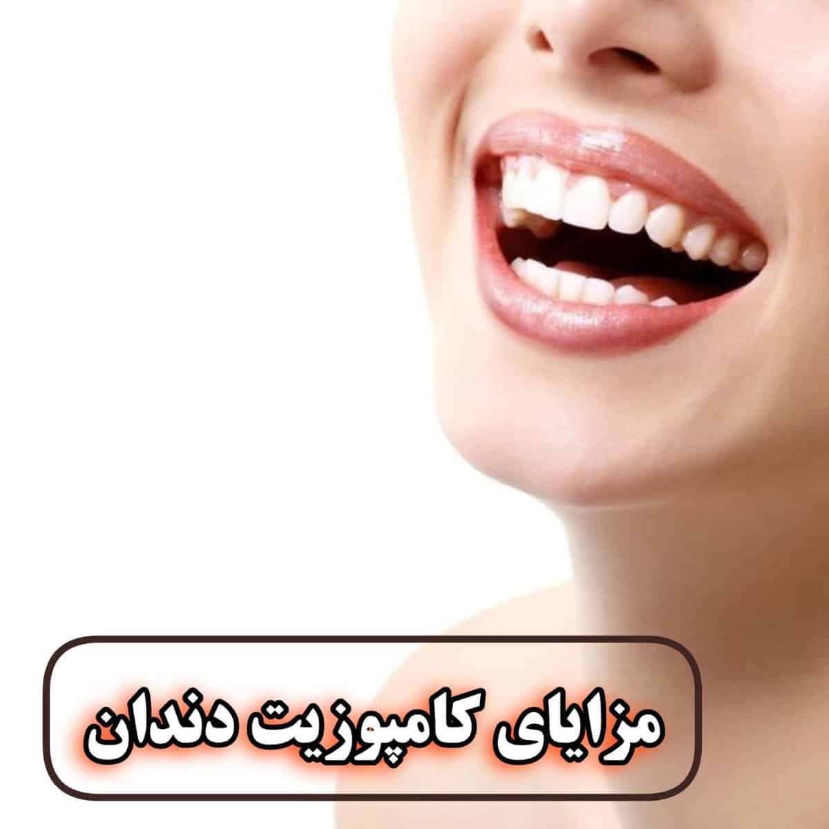 نصب کامپوزیت دندان