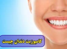 کامپوزیت دندان چیست + عکس قبل و بعد کامپوزیت