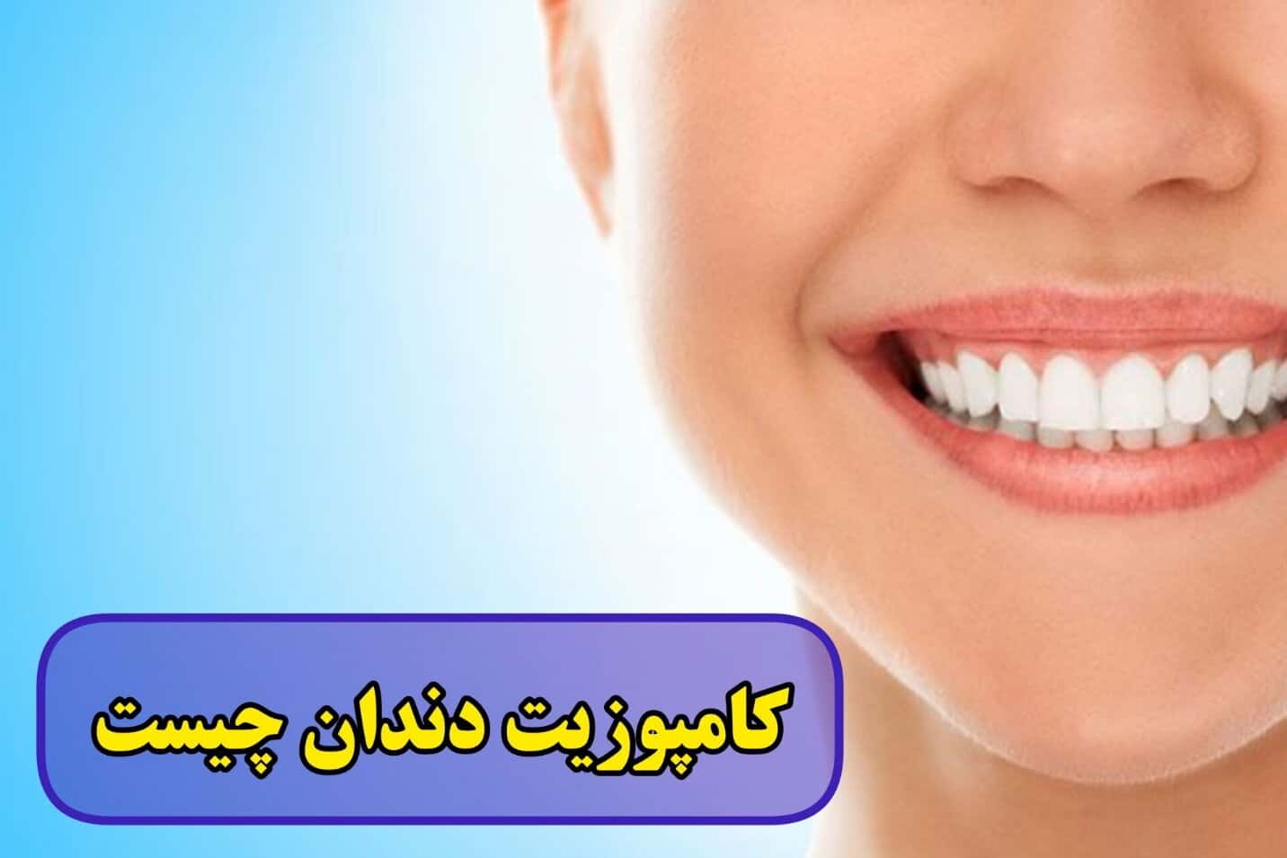 کامپوزیت دندان چیست + عکس قبل و بعد کامپوزیت