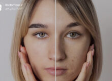 بهترین کلینیک زیبایی در قم