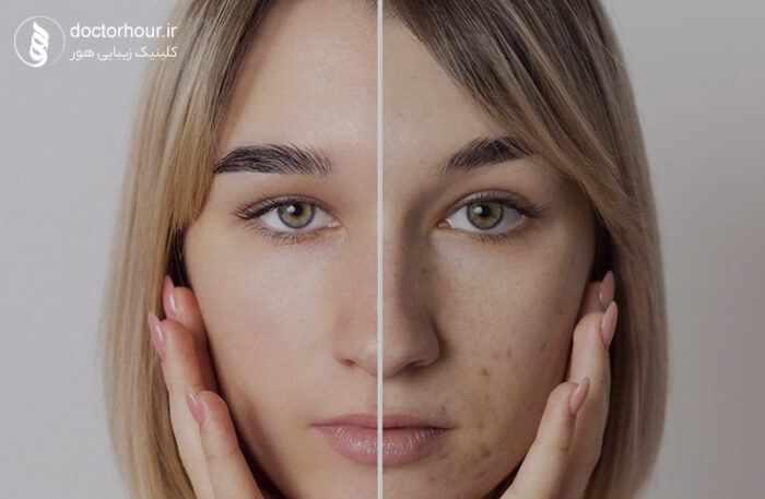 بهترین کلینیک زیبایی در قم